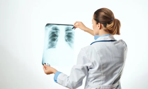 Pleural Effusion? Causes, Symptoms, and Treatment Options
