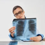 Is Pleural Effusion Dangerous?