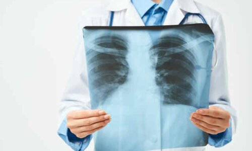 Symptoms of Lung Fibrosis